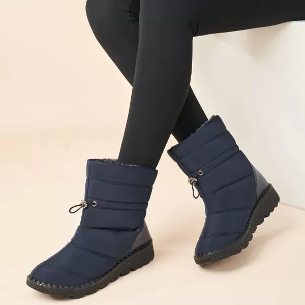 Alicegana Snow Boots for Women Winter: Warm Fur Lined Waterproof Slip on Comfortable Outdoor Womens Boots