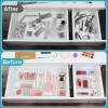 imageVtopmart 88PCS Clear Plastic Drawer Organizers Set 5Size Versatile Bathroom Drawer Organizer Trays Storage Bins for Makeup Vanity Kitchen Gadgets Utensils and Office88 PCS