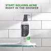 imageDOVE MEN  CARE Advanced Care Cleanser Acne Clear 3 Count for Acne Prone Skin Face  Body Cleanser with 1 Salicylic Acid 169 oz